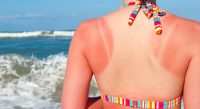 Nationaal Zonrapport: verbranding door de zon nog aan de orde van de dag